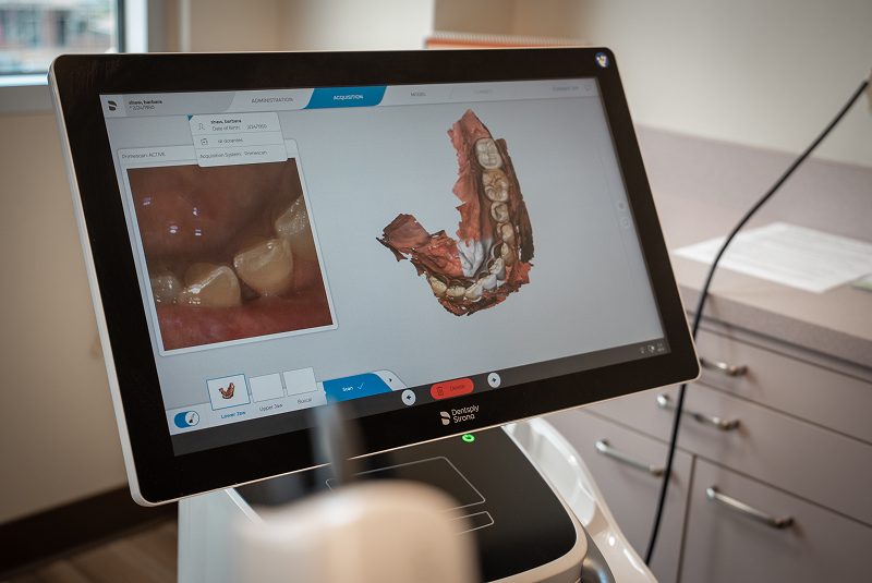 digital imaging of mouth