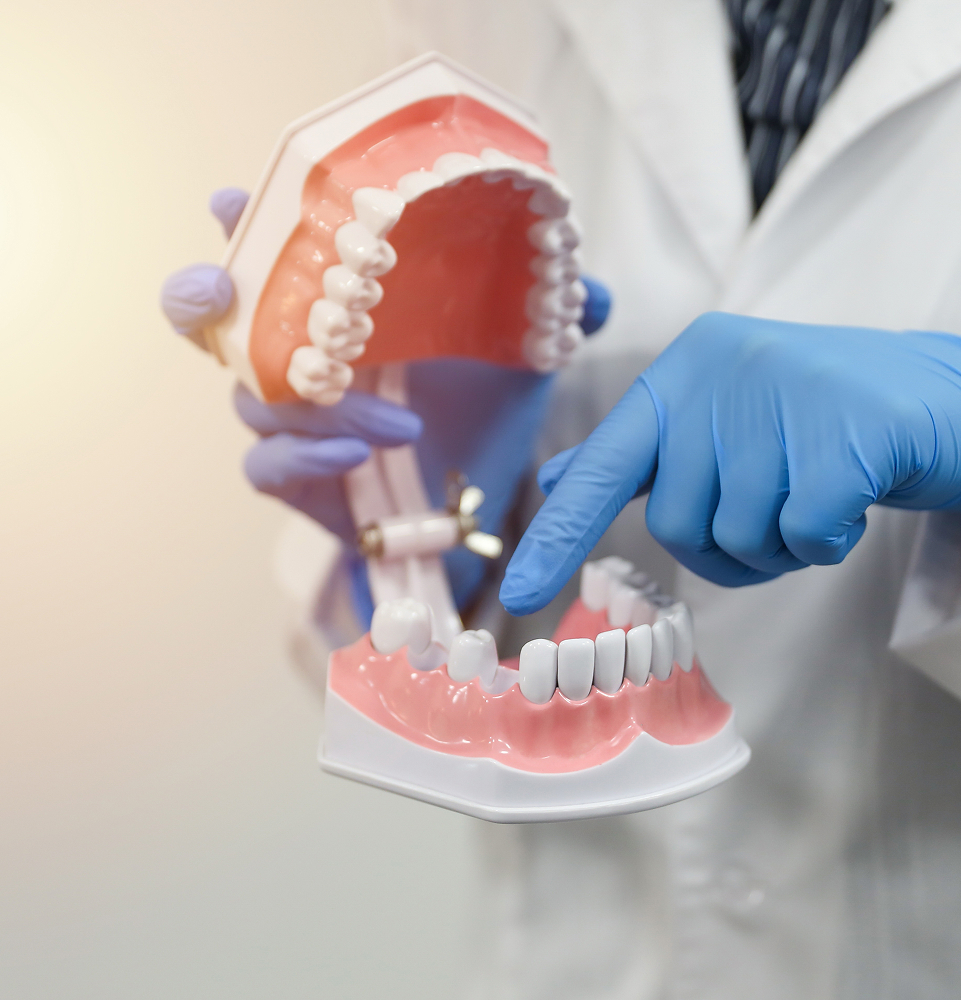 model with missing teeth