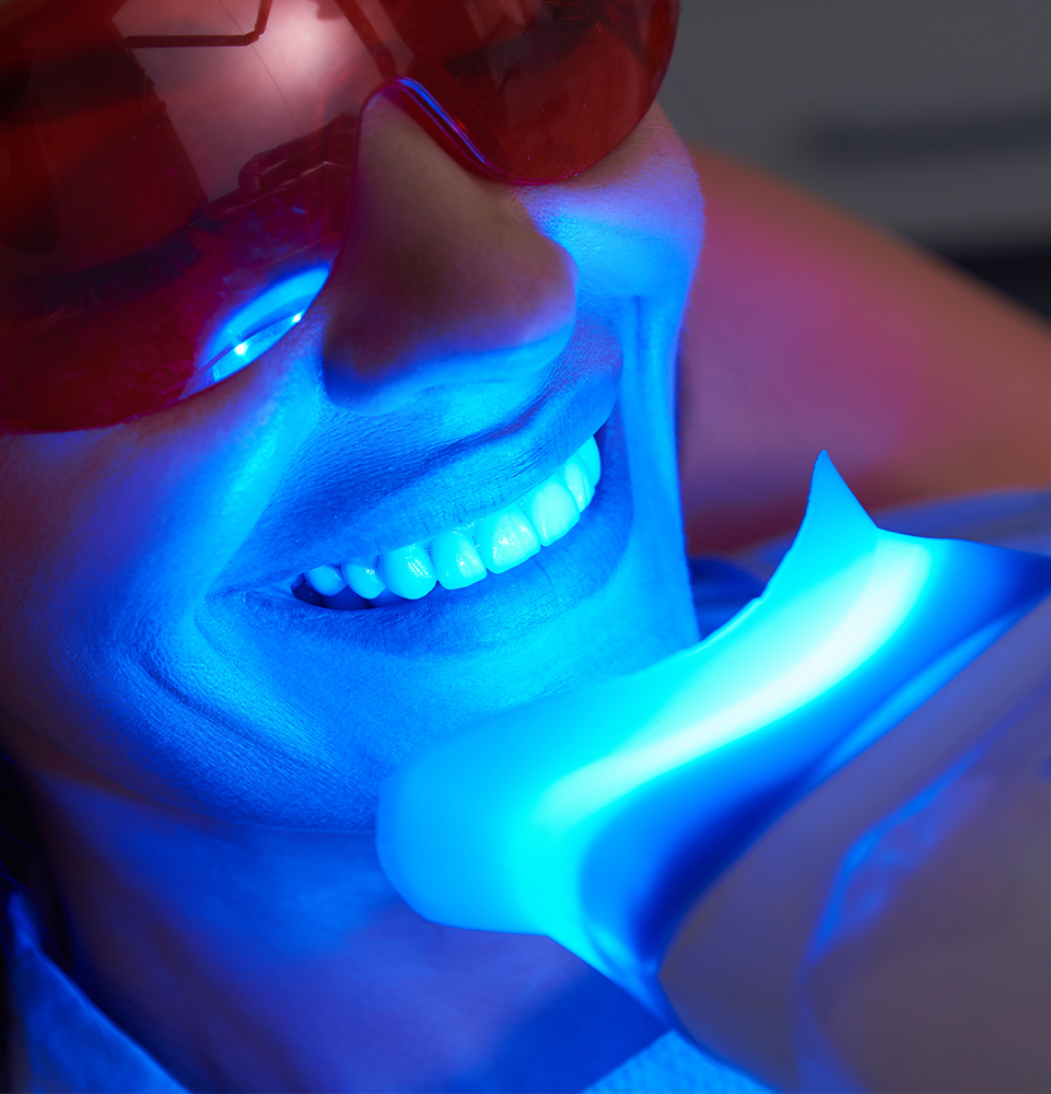 a woman professionally getting her teeth whitened