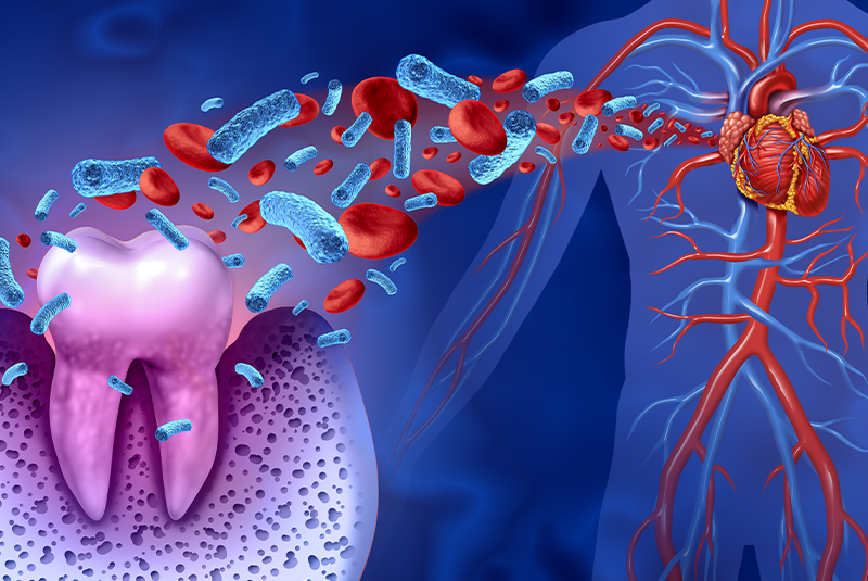 illustration of how gum disease can affect more then your oral health