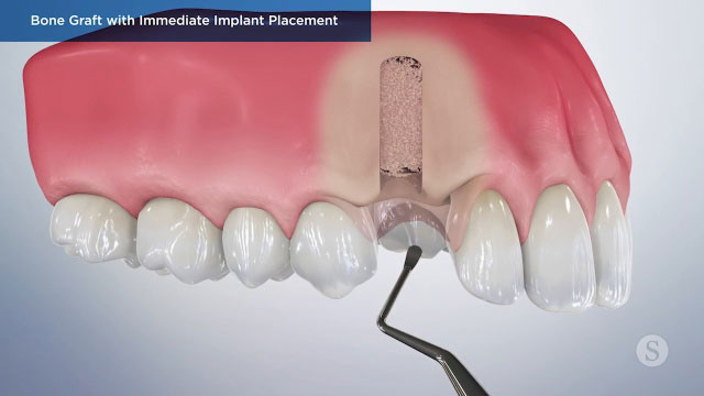 Patient Education Video 12 Thumbnail