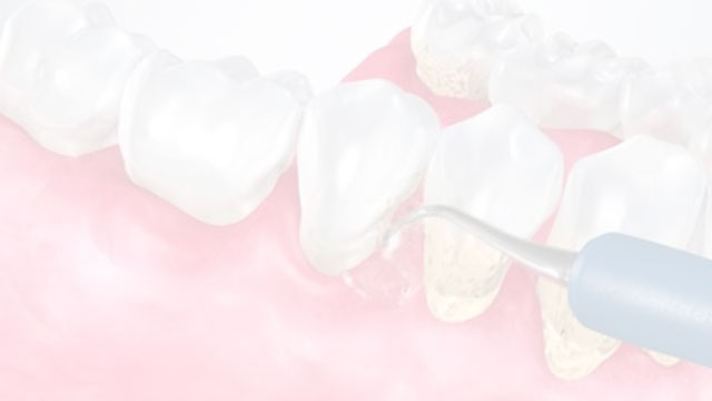 Patient Education Video 15 Thumbnail