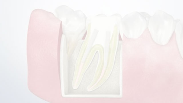 Patient Education Video 2 Thumbnail