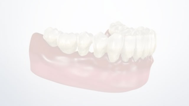 Patient Education Video 6 Thumbnail