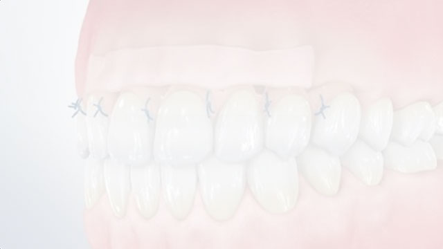 Patient Education Video 7 Thumbnail