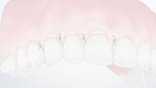 Patient Education Video 8 Thumbnail