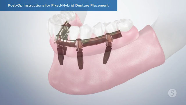 Patient Education Video 10 Thumbnail
