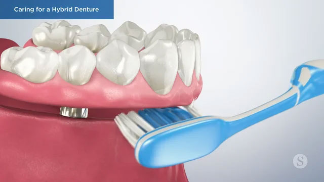 Patient Education Video 14 Thumbnail