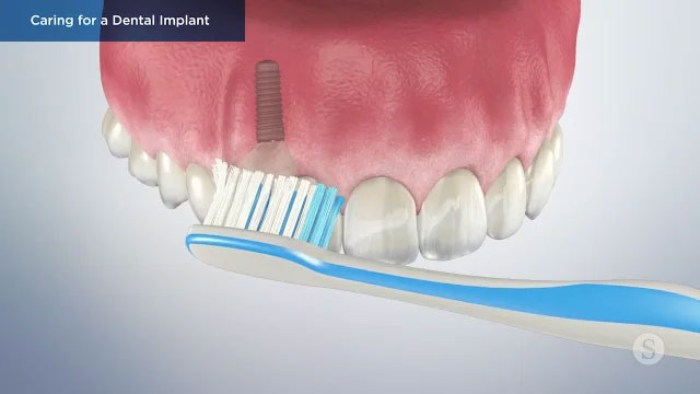 Patient Education Video 13 Thumbnail