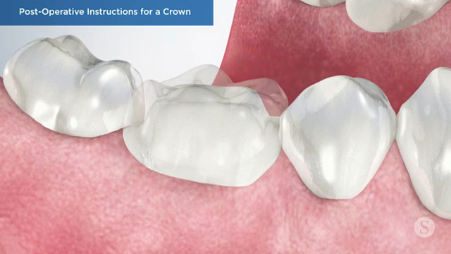Patient Education Video 1 Thumbnail