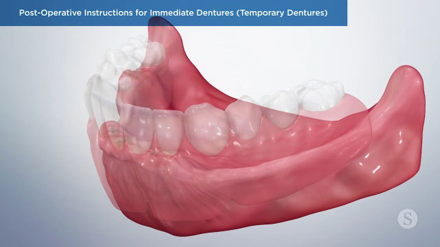 Patient Education Video 9 Thumbnail