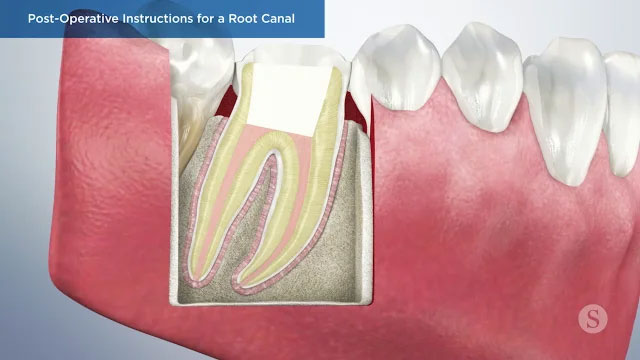 Patient Education Video 5 Thumbnail