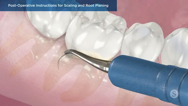 Patient Education Video 4 Thumbnail
